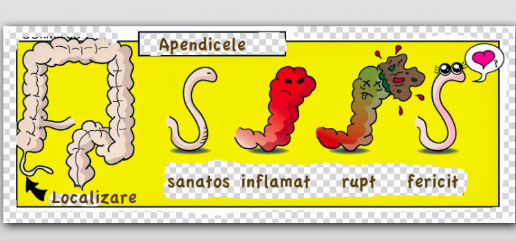 Semnele apendicitei. Tratament sau operație?