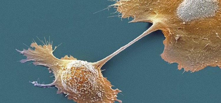 Revoluţie în oncologie: Medicamentul care “trezeşte” sistemul imunitar