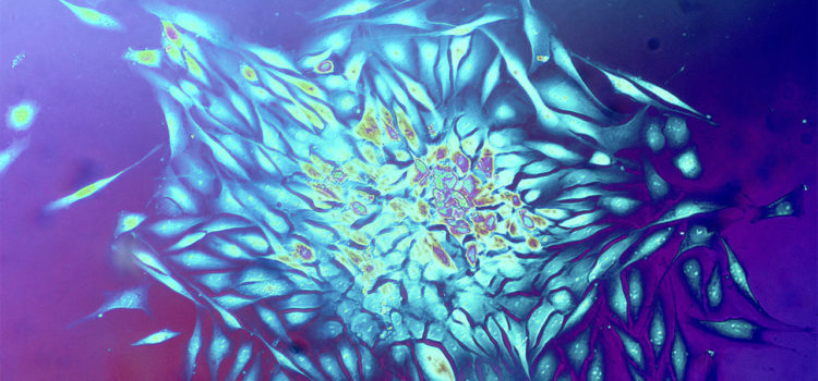 DESCOPERIRE URIAŞĂ / Erorile ADN-ului uman duc la cancer