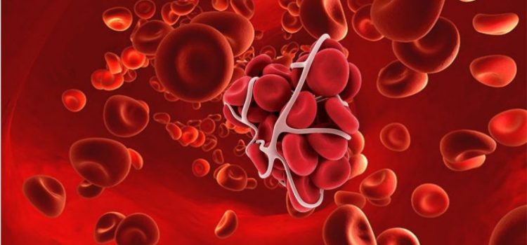 COVID-19 / Anticoagulantele pot salva viețile pacienților